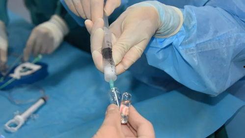 放支架手术视频,高清视频带你直观了解手术全过程